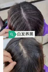 -诗碧曼养发