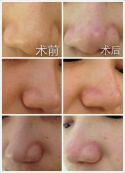 光SPA水氧＋opt-光SPA科技美肤