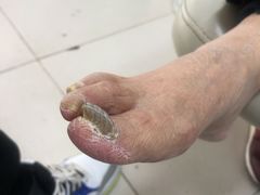 -新甲连锁灰指甲·甲沟炎·鸡眼(黑龙江路店)