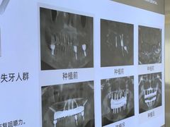 -合众齿科高难度矫正·种植·儿牙中心(望京总院)