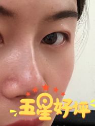 体验后-禾丽康美医疗美容医院