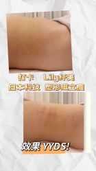 -Lily纤美·科技减脂中心