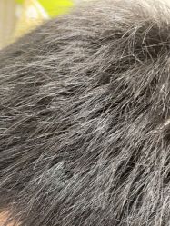 -熙朵美学植发连锁