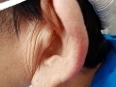 -安湃声助听器(密云店)