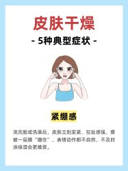 -克丽缇娜