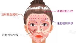 -北京米扬丽格医疗美容·联合丽格鼻整形中心