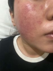 -美瑞莎创美医疗美容