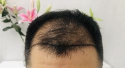 -熙朵美学植发·连锁品牌