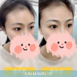 -久匠·野生眉半永久纹眉