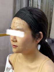-Yestar重庆艺星医疗美容医院