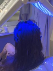 -碧莲盛·脱发养发中心