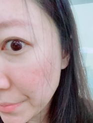 -More摩尔医美の注射线雕光电中心