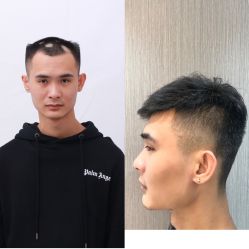 -发饰美男士增发补发假发定制店