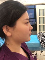 -新美荟医美·专注面部美学抗衰