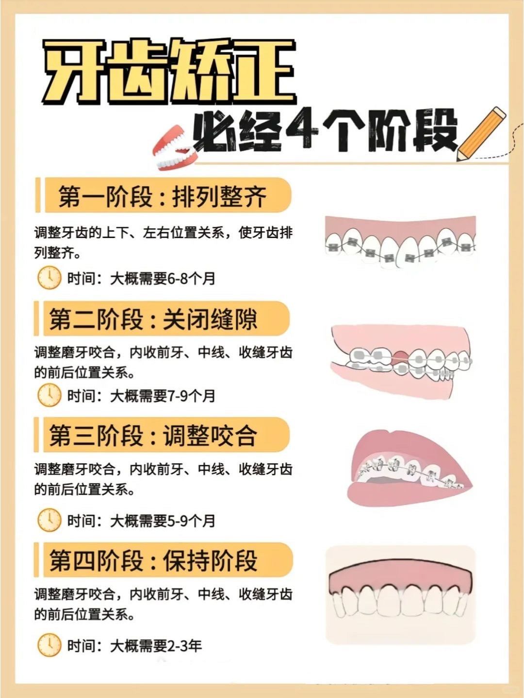 牙齿矫正必经过程图解!看完收获满满