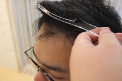 点击看大图 -大麦微针植发丨全国连锁