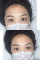 点击看大图 -杨益美学·野生眉半永久纹眉发际线