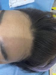 -广州美莱医疗美容医院