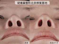 -北京米扬丽格医疗美容·联合丽格鼻整形中心