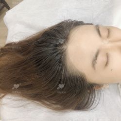 点击看大图 -西施无菌半永久纹绣眉眼影唇轻增发纹发际线