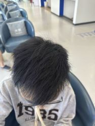 -大麦微针植发全国连锁