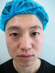 -天津健丽·去眼袋医疗美容机构