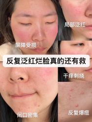 -Boss H Beauty美肌中心