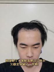 -雍禾植发全国连锁