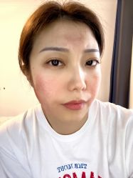 点击看大图 -广东韩妃整形外科医院