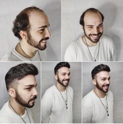 -发饰美男士增发补发假发定制店