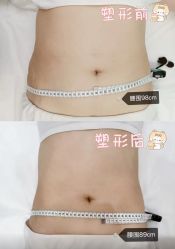 -Lily纤美·科技减脂中心