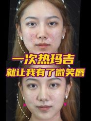 点击看大图 -长沙雅美医疗美容医院