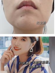 -More摩尔医美の注射线雕光电中心