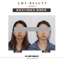 -丽美妍医疗美容·皮秒·立体分层抗衰