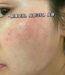 -美肤盾祛痘·问题肌头疗管理中心