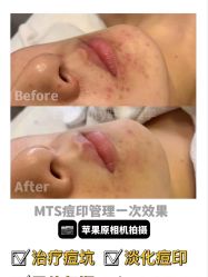 -E.beauty驻颜·痘敏肌调理中心