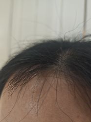 -广州美莱医疗美容医院