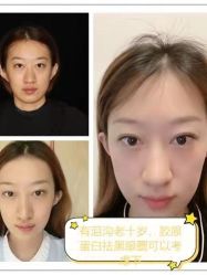-广东韩妃整形外科医院