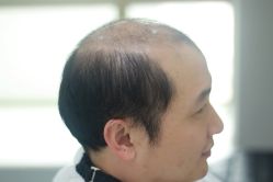 -发饰美男士增发补发假发定制店