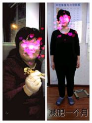 android_upload_pic-维纳斯专业减肥