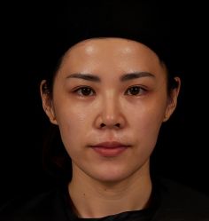 -Dr.U博士医疗美容医院