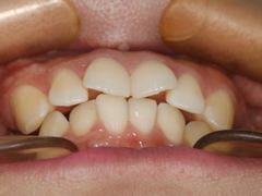 -同步齿科·数字化正畸种植口腔中心(珠海店)