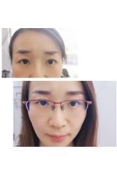 没有尴尬期的丝雾眉-平萍纹绣韩式半永久定妆
