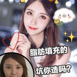 脂肪填充的坑你造吗？