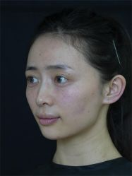 -Yestar重庆艺星医疗美容医院