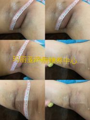 -玛丽亚妇产医院产后修复·医美产康中心