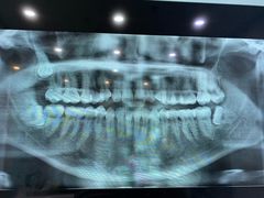 -土豆口腔(凤凰北总店)