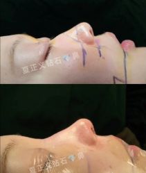 -北京米扬丽格医疗美容·联合丽格鼻整形中心