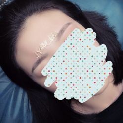 点击看大图 -郡艺医疗美容·微整·眼鼻吸脂