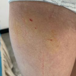 -上海玫瑰医疗美容医院